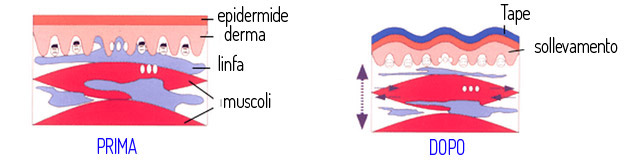 Effetto convolluzione
